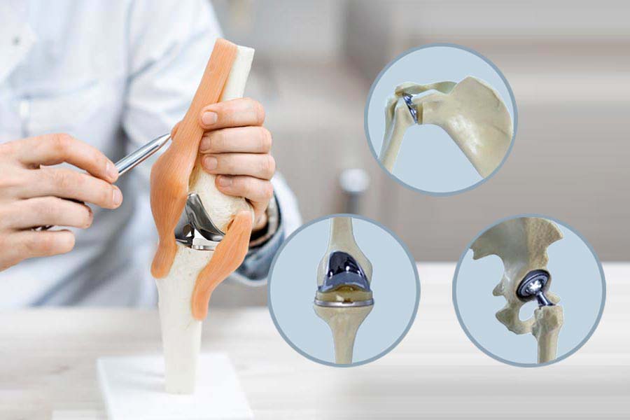 knee replacement orange county ca 1
